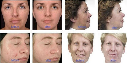 9 In 1 Intelligent Multifunctional Professional Machine